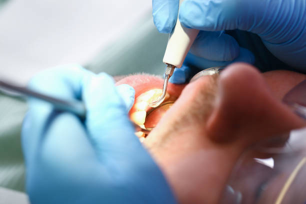 Best Walk-In Emergency Dentist in Toquerville, UT