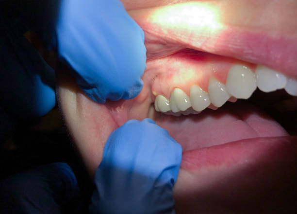 Best Walk-In Emergency Dentist in Toquerville, UT