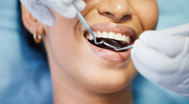 Best Emergency Wisdom Teeth Removal in Toquerville, UT