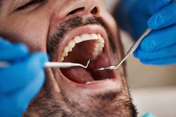 Best Emergency Dental Care for Trauma or Injury in Toquerville, UT